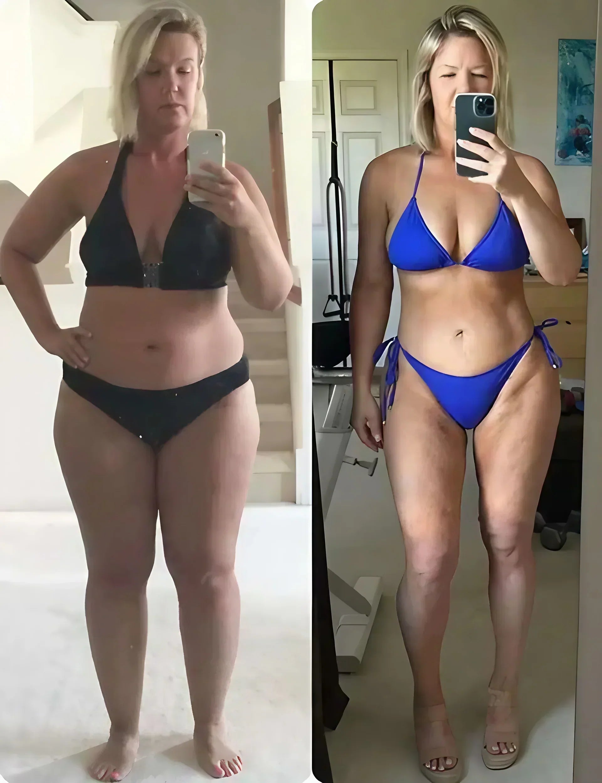 Women with Swollen, Achy Legs Are Turning to This Non-Surgical Routine